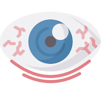 Eye Disease